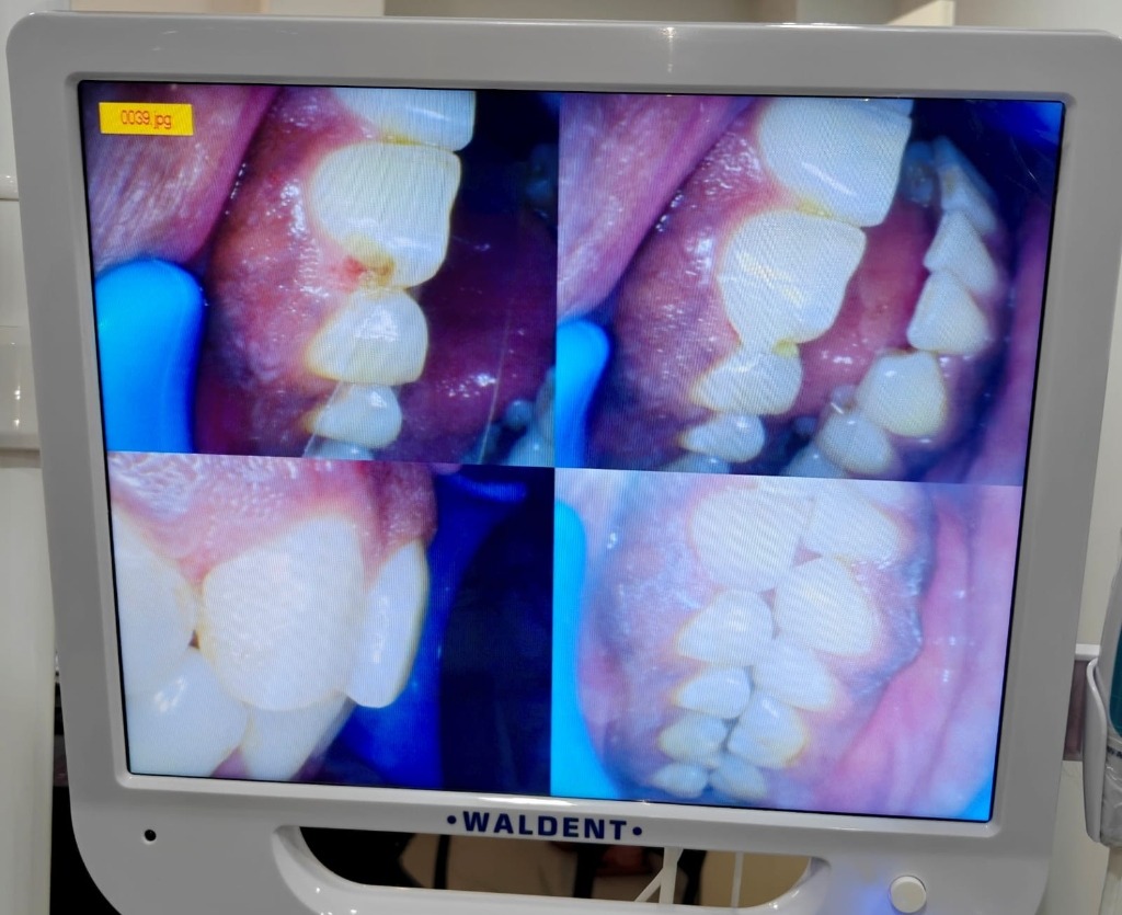 Real high-definition consultation and operatory suite at ORIS Speciality Dentistry